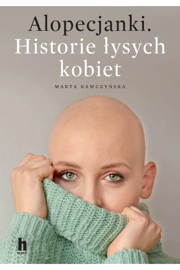 Alopecjanki. Historie łysych kobiet