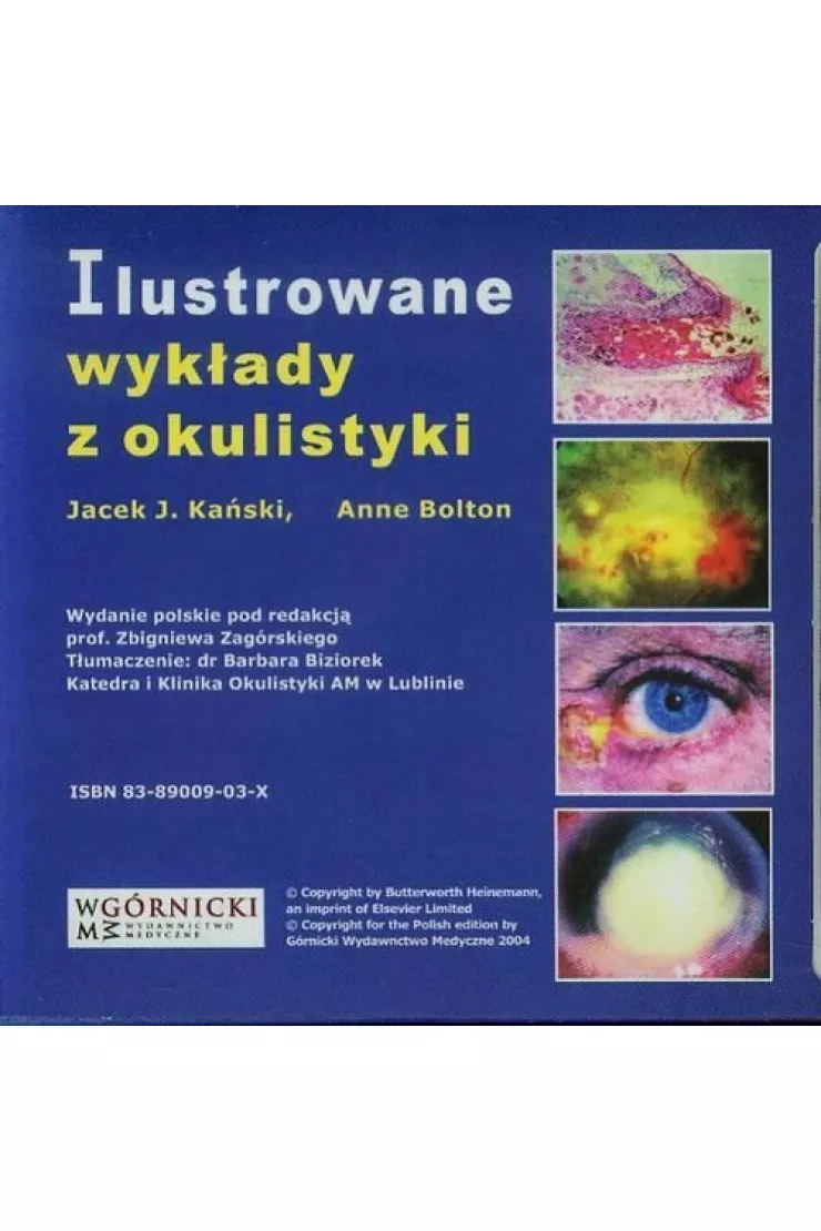 Ilustrowane wykłady z okulistyki. Płyta CD